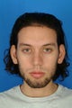 Septoplasty and Rhinoplasty