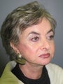 65 yr old woman with Laser Resurfacing