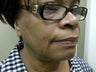 Mini lift providing natural results for an African American female