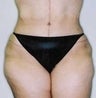 34 year old female patient