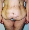 34 year old female patient
