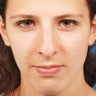 15 - 25 Year Old Female