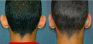 Young male wanted less projected Ears
