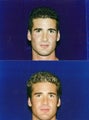 Revision Rhinoplasty