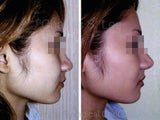 Nose