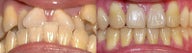 orthodontic treatment