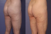 Cellulaze