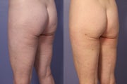 Cellulaze