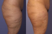 Cellulaze