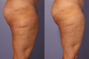 Cellulaze