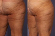 Cellulaze