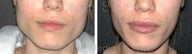 Jaw