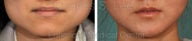 Jaw