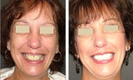 Cosmetic Dentistry