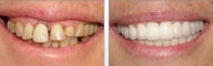 Cosmetic Dentistry