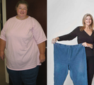 Laparoscopic Roux-en-Y Gastric Bypass