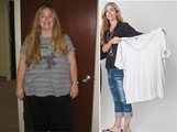 Laparoscopic Roux-en-Y Gastric Bypass