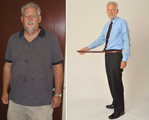 Laparoscopic Gastric Bypass