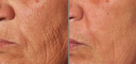 Pearl & Pearl Fractional