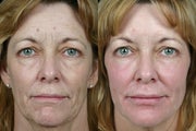 Pearl Fractional