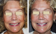 Cosmetic Dentistry