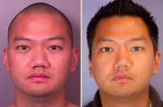 Rhinoplasty