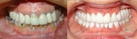 Extreme Dental Makeover