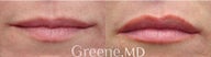Female with natural lip enhancement
