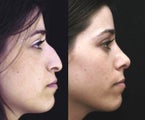 nose