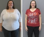 Before & After