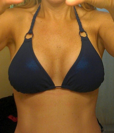 brea realself breast augmentation 350cc cost