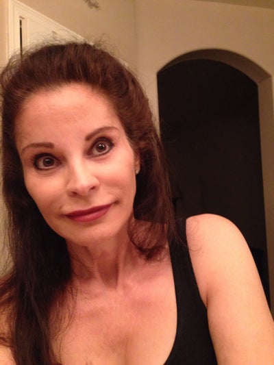 Im A 57 Year Old Female With Wrinkles And Loose Skin Should I Do A