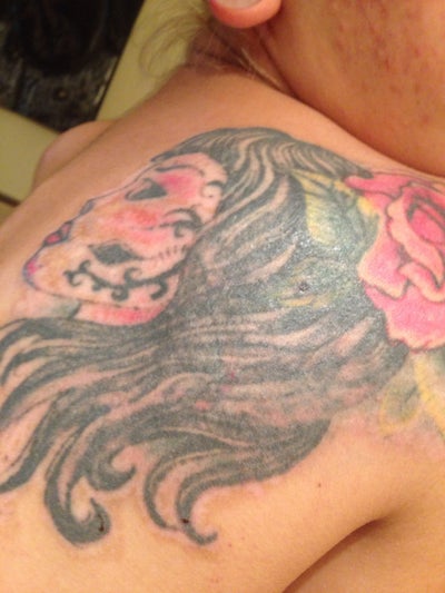 Picosure Laser on Tattoo Cover Up - Miami, FL - PicoSure ...