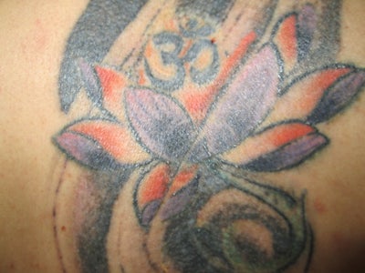 Documenting my Tattoo Removal Using the Alex Tri Vantage ...