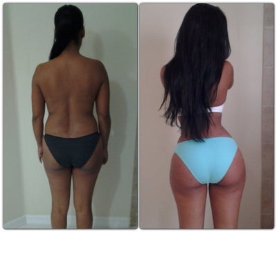 Brazillian Butt Lift Prices 97