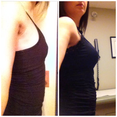 debachery nude videos 375cc breast implants
