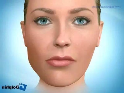 Facial Asymetry 35