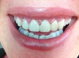 Sore Gums - Trusted Health Resources - THP.