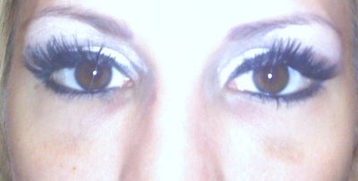 Is This The Tyndall Effect or a Healing Bruise Under Eyes? (photo