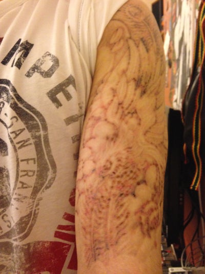 Half Sleeve Tattoo Removal - Nottingham, MD - Tattoo ...