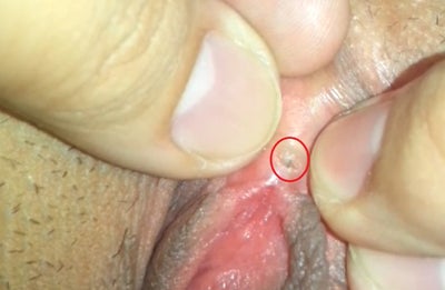 Young vulvas vulvas Tie down male orgasm delay