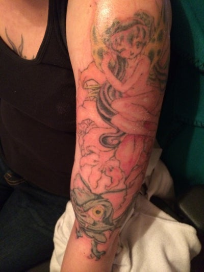 Year Old Tattoo Removal- Picosure- Tataway - Boston, MA ...
