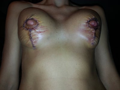 Severed Tits 8