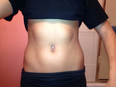 Belly Button Piercing Rejection Scar