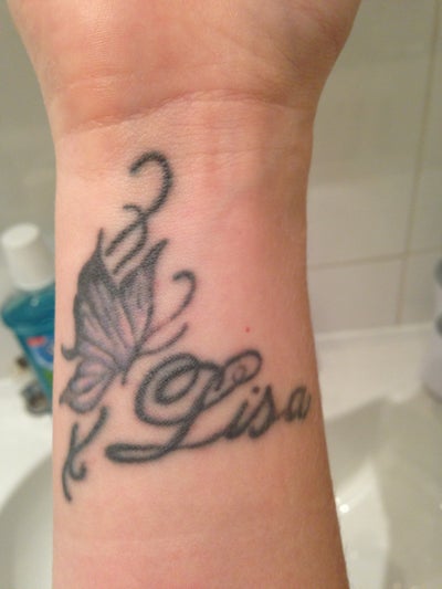 Wrist Tattoo Removal - London, GB - Tattoo Removal review - RealSelf