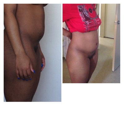 ago not sure cost $ 5000 yily de los santos md dominican republic do