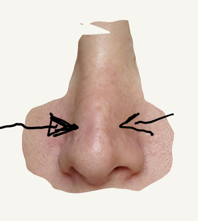 Steroid injection nose scar tissue