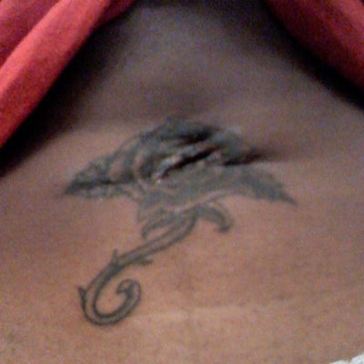 can tattoo be removed on darker skin photo doctor can tattoo be removed on darker skin photo doctor