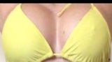 highprofileimplants