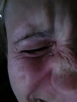 Botox, Fillters in Dade or Broward on the Weekends?